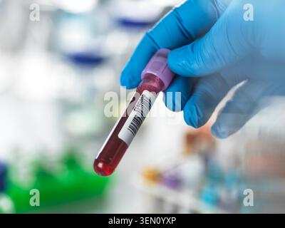 Hand mit Handschuhen, die ein Blutprobenröhrchen mit Strichcode in Laborumgebung hält. Stockfoto