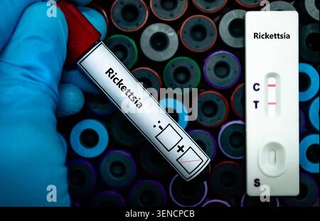 Blutprobe eines Patienten-positiven Ergebnisses bei Rickettsie. Stockfoto