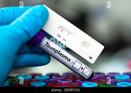 Blutprobe eines Patienten-positiven Toxoplasma-Ergebnisses. Stockfoto
