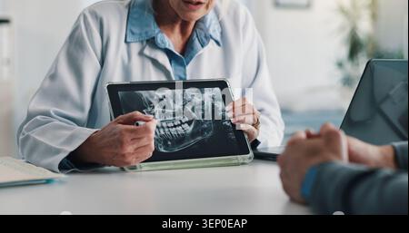 Person, Hände oder Zahnarzt mit Tablet-Bildschirm für Röntgenuntersuchung, Test oder medizinische Verfahren im Krankenhaus. Medizinisches Fachpersonal, Arzt oder zeigender Kiefer des Patienten Stockfoto