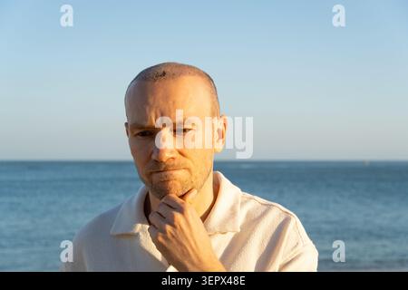 Trauriger, nachdenklicher Mann nach einer Haartransplantation, der auf den Strand blickt Stockfoto