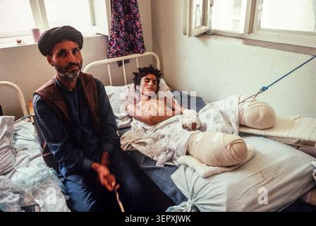 IKRK-Krankenhaus, Kabul, Afghanistan, August 1992; Amputierte in postoperativer Genesung. Nach 14 Jahren Krieg ist das County ein Minenfeld mit über 56.000 Amputierten. Stockfoto