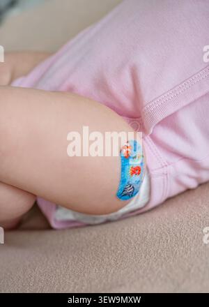 Vertikale Hochwinkelansicht eines niedlichen Baby Oberschenkels in einem rosa Body, mit einem hellblauen pädiatrischen Haftbandage Streifen mit Mustern nach medizinischen Stockfoto