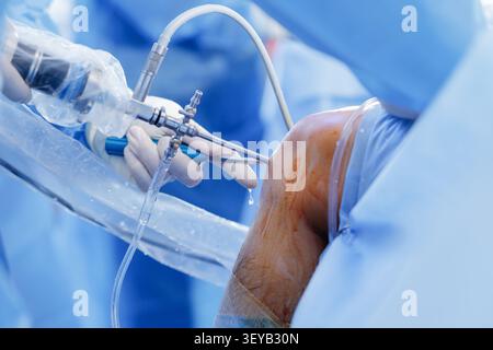 Nahaufnahme der Kniearthroskopie während einer Meniskusreparatur unter Darstellung chirurgischer Instrumente und des chirurgischen Umfeldes. Stockfoto