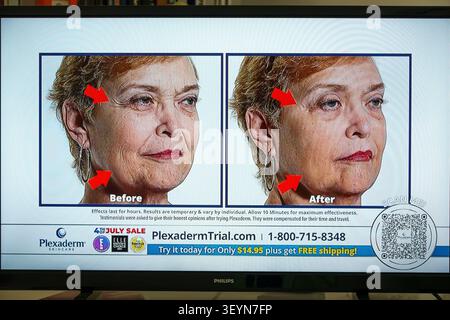TV-Kabel-Fernseh-Bildschirmmonitor, Plexaderm, Plexaderm Skincare, vor und nach, Vor-Nach-Vergleich, ältere Frau, Seniorin, reife Frau Stockfoto