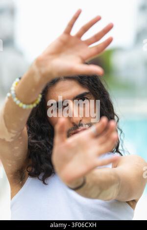 Porträt eines Mannes aus dem Nahen Osten mit Vitiligo, langen Haaren und Bart, der in kreativer Pose die Hände zur Kamera hebt und Konfi ausdrückt Stockfoto