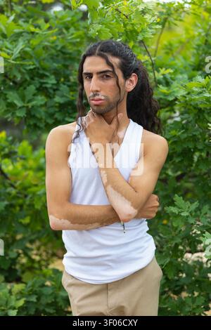 Porträt eines Mannes aus dem Nahen Osten mit Vitiligo, der draußen zwischen üppigem Grün steht, ein weißes Tanktop trägt und nachdenklich mit der Hand posiert Stockfoto