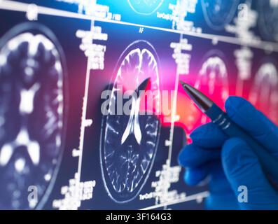 Neurologie-Forschung, konzeptionelles Bild. Wissenschaftler betrachtet Hirn-Magnetresonanztomographie (MRT)-Aufnahmen. Stockfoto