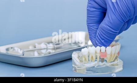 Nahaufnahme eines Zahnarztes, der auf eine Zahnimplantat-Krone an einem anatomischen Kiefermodell zeigt. Edelstahlablage mit Zahninstrumenten im unscharfen Hintergrund Stockfoto