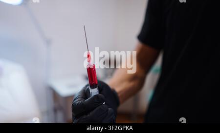 Behandschuhte Hand hält eine Spritze mit roter Flüssigkeit für die ästhetische Behandlung Stockfoto