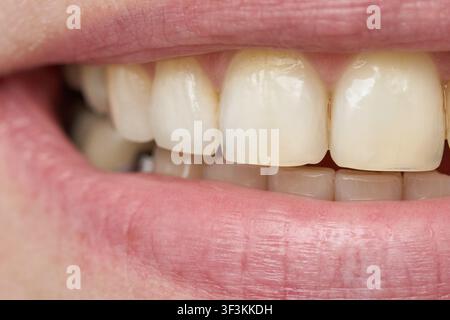 Seitenansicht von oberen und unteren Vorderzähnen in entspanntem Lächeln, Nahaufnahme, die Zahnkanten, Schmelztextur und Zahnfleischkontur zeigt. Stockfoto