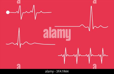 Herzschlag-EKG-Monitor-Wellenform-Satz - medizinische Kardiologie-Pulslinien-Icons Stock Vektor