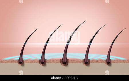 Reihe mehrerer Haarsträhnen mit Schutzschicht auf der Kopfhautoberfläche - 3D-Illustration Stockfoto
