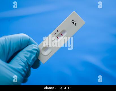 Blutprobe eines Patienten-positiven CEA-Ergebnisses. Stockfoto