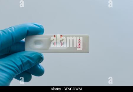 Blutprobe eines Patienten mit positivem Befund für CCHF. Stockfoto