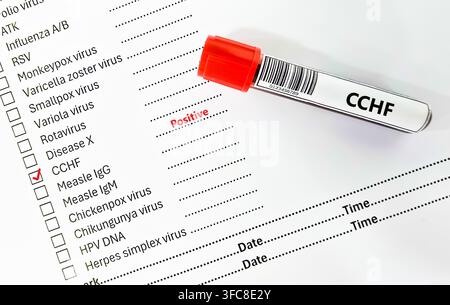 Blutprobe eines Patienten mit positivem Befund für CCHF. Stockfoto