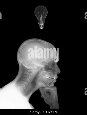 Röntgensilhouette einer Person im Profil, die tief nachdenkt, symbolisiert menschliche Selbstreflexion, die Entstehung neuer Konzepte und eine brillante Idee, die beleuchtet Stockfoto