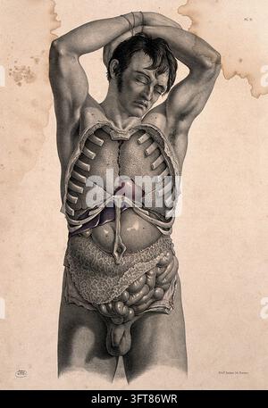 Sezierung des Rumpfes eines stehenden Mannes. Farbige Lithografie von J. Maclise, 1851 Stockfoto