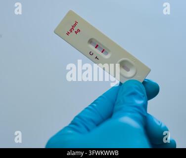 Blutprobe eines Patienten mit positivem Befund für H.pylori. Stockfoto