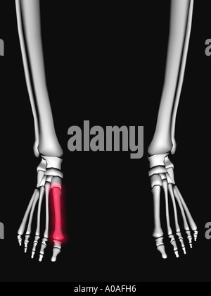 Anschauliches Diagramm zeigt Skelett zeigt einen Mittelfußknochen in ein rotes Licht hervorgehoben Stockfoto