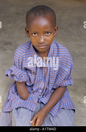 RÜCKKEHR NACH RUANDA MÄRZ 1995 MUSHIKIWABO 9 SCHUSS IN DEN ARM WURDE SPÄTER AMPUTIERT Stockfoto