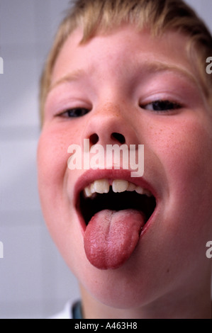 Kind mit Scharlach Stockfoto