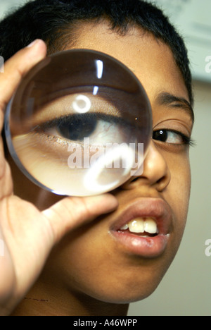 Low Vision: Junge hält eine starke Schleife auf seinem Auge, Sao Paulo, Brasilien Stockfoto