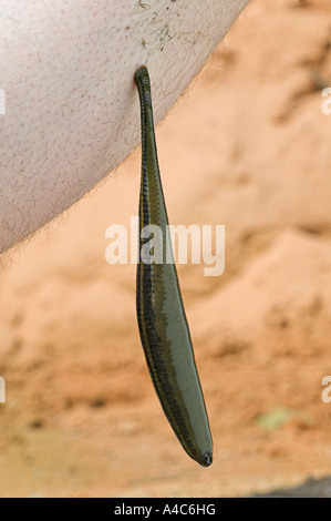 Medizinische Blutegel (Hirudo Medicinalis) ernähren sich von menschlichen Bein Stockfoto