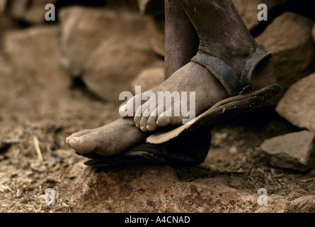 DEN TÄGLICHEN KAMPF UMS ESSEN MIT DEM KOMMEN EINER NEUEN HUNGERSNOT MESHAL DORF, MAI 1991. DANIEL IST SANDALEN GETRAGEN. Stockfoto