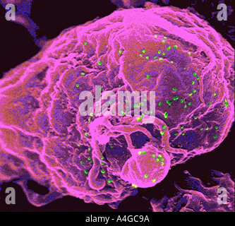 Scanning Electron Schliffbild zeigt eine Lymphozyten rote Pünktchen HIV-Partikel grüne Knospen von der Oberfläche Stockfoto