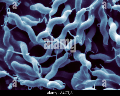 Dies ist eine erweiterte Farbe Scan Elektron Schliffbild von Bakterium Campylobacter jejuni Stockfoto