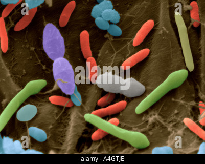 Scanning Electron Schliffbild (SEM) - Bakterien aus menschlichen Fäkalien gemischt Stockfoto