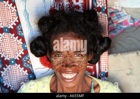 Frau trägt eine Schlamm-Maske in Ifaty, nördlich von Toliara (Tulear), Madagaskar Stockfoto