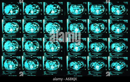 MRI-scans Stockfoto