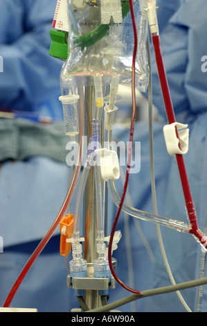 DEU Deutschland Westdeutsches Herzzentrum Essen Klinik für Thorax und Kardiovaskulare Chirurgie DEU Germany Essen Westdeutsches Herzzentrum Klinik für Thorax- und Herz-Kreislauf-Chirurgie WICHTIG Fotos duerfen nicht für Werbung PR anderer Kliniken Krankenhaeuser eingesetzt werden Stockfoto