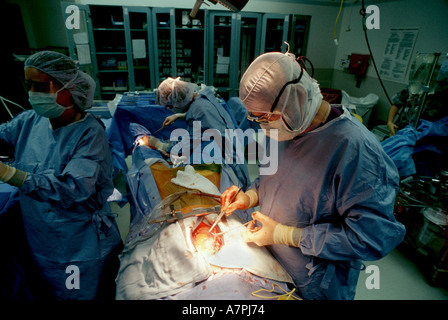 Ein Chirurg arbeitet an einem Patienten während der Herzchirurgie in Colorado USA Stockfoto