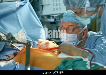 Ein Chirurg arbeitet auf Patienten während der erfolgreichen offenen Herzchirurgie in Ohio USA Zentralkrankenhaus Stockfoto