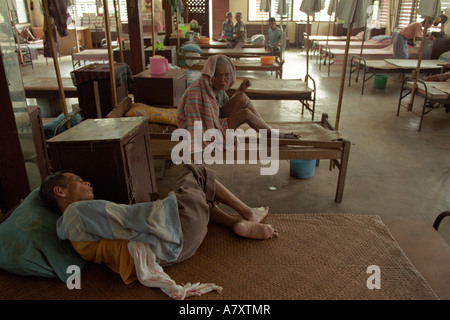 Asien, Philippinen, Panay Island, Santa Barbara, Mann leidet unter Lepra gemeinsam Ward in Western Visayas Sanatorium Stockfoto