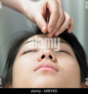 Chinesische Medizin orientalischen Medizin Hand Anwendung von Akupunktur auf Gesicht des Patienten Stockfoto