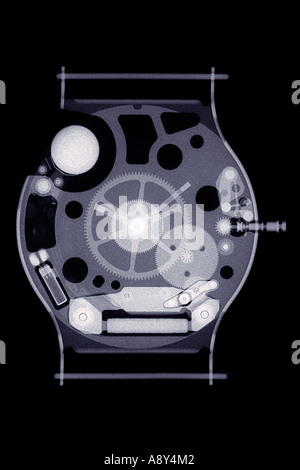 Einer Röntgenaufnahme eine Uhr in einem Kunststoff-Gehäuse (Swatch). Radiographie d ' une Montre À Boîtier Plastique (Swatch). Stockfoto