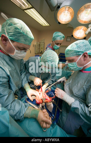 Chirurgen Bauchchirurgie Krebs Operation OP-Saal Stockfoto
