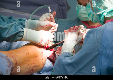 Hüftoperation Hüftgelenk Endoprothese Chirurgie nach Hals des Femur Fraktur Osteoporose Stockfoto