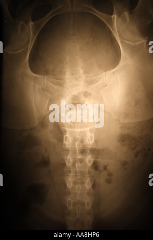 XRAY DER WEIBLICHEN BAUCHREGION VERTIKALEN BAPDB7318 Stockfoto