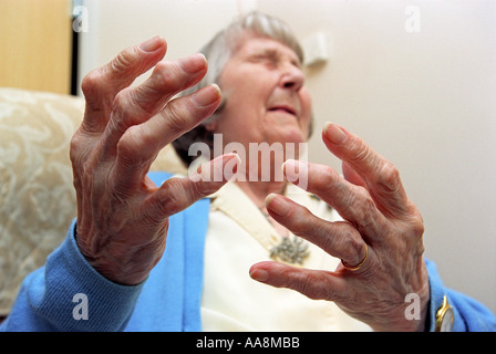 Arthritis, eine ältere Dame mit schwerer Arthritis, arthritischen Händen Stockfoto