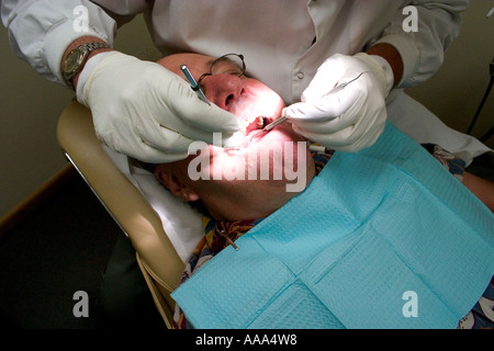 Fotograf Steve Skjold Alter 66 mit seinen Zähnen in zur Reparatur. Robbinsdale Minnesota MN USA Stockfoto