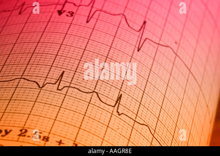 abstrakte EKG Elektrokardiogramm-Detailansicht Stockfoto