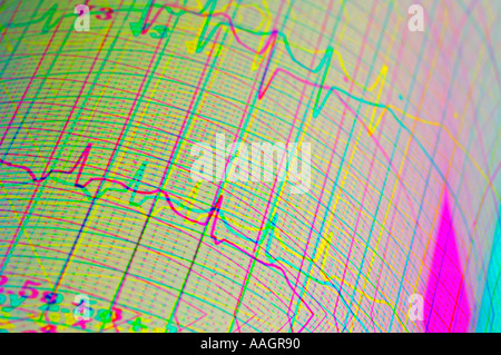 abstrakte EKG Elektrokardiogramm-Detailansicht Stockfoto