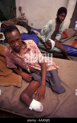 Opfer von mir im zweiten Weltkrieg zwischen UNITA und Angola Streitkräfte, Kuito Krankenhaus, Provinz Bié, Angola, Afrika, 1996. Stockfoto