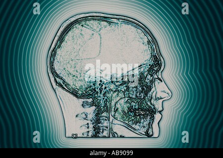 Menschliche Gehirn Stockfoto