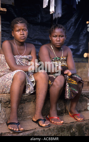 Africa Sierra Leone 1999 Opfer des Krieges Amputierte Camp für diejenigen waren deren böswillig abgehackt Stockfoto